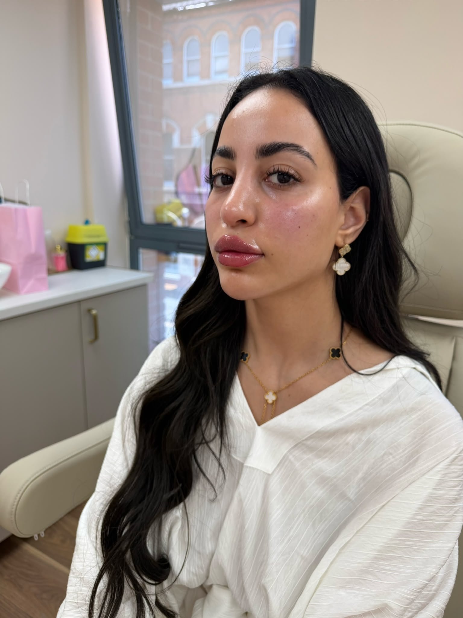 Fat dissolving treatment consultation at Simply Enhanced