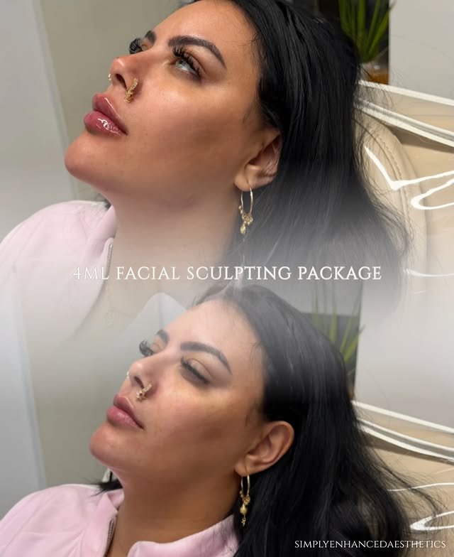 Before and after treatment result