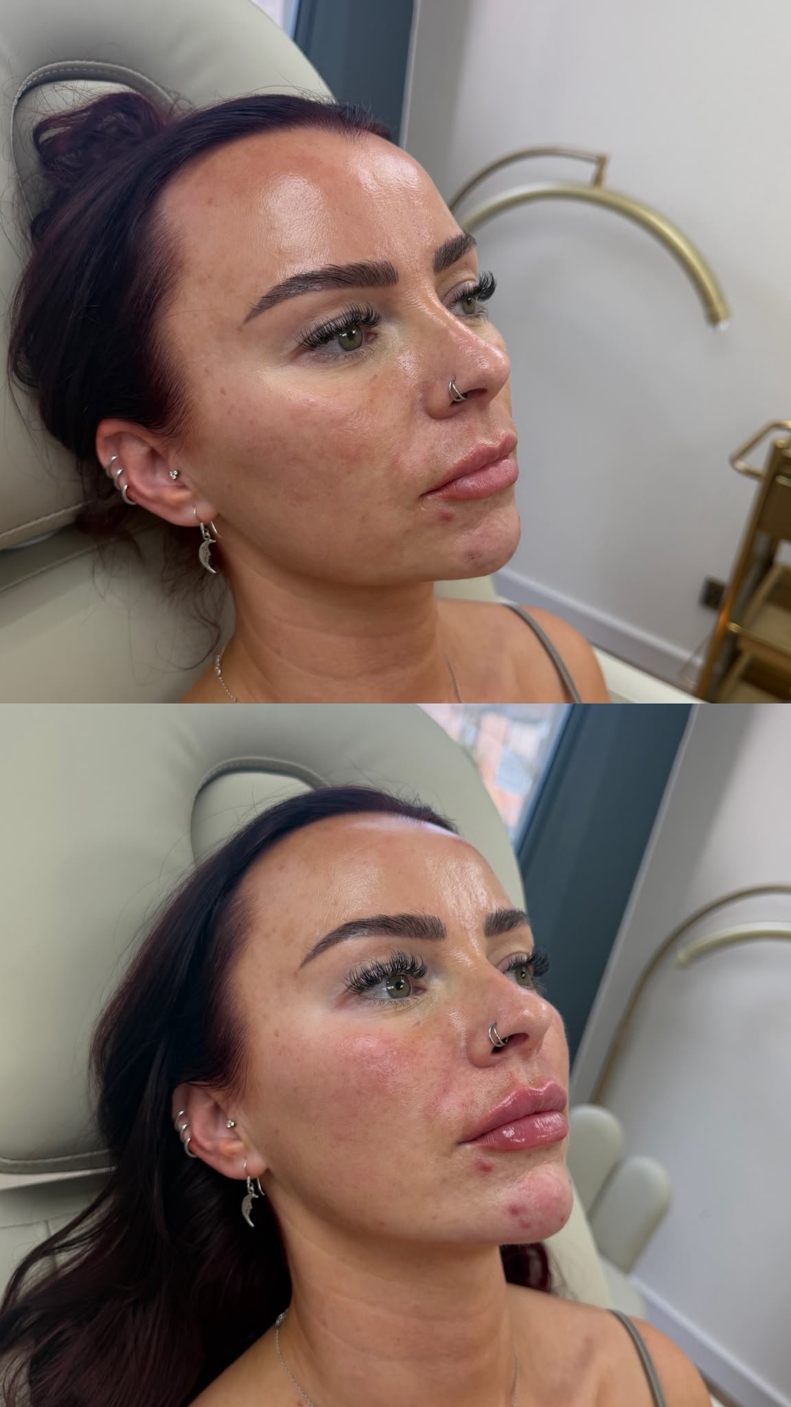 Before and after treatment result