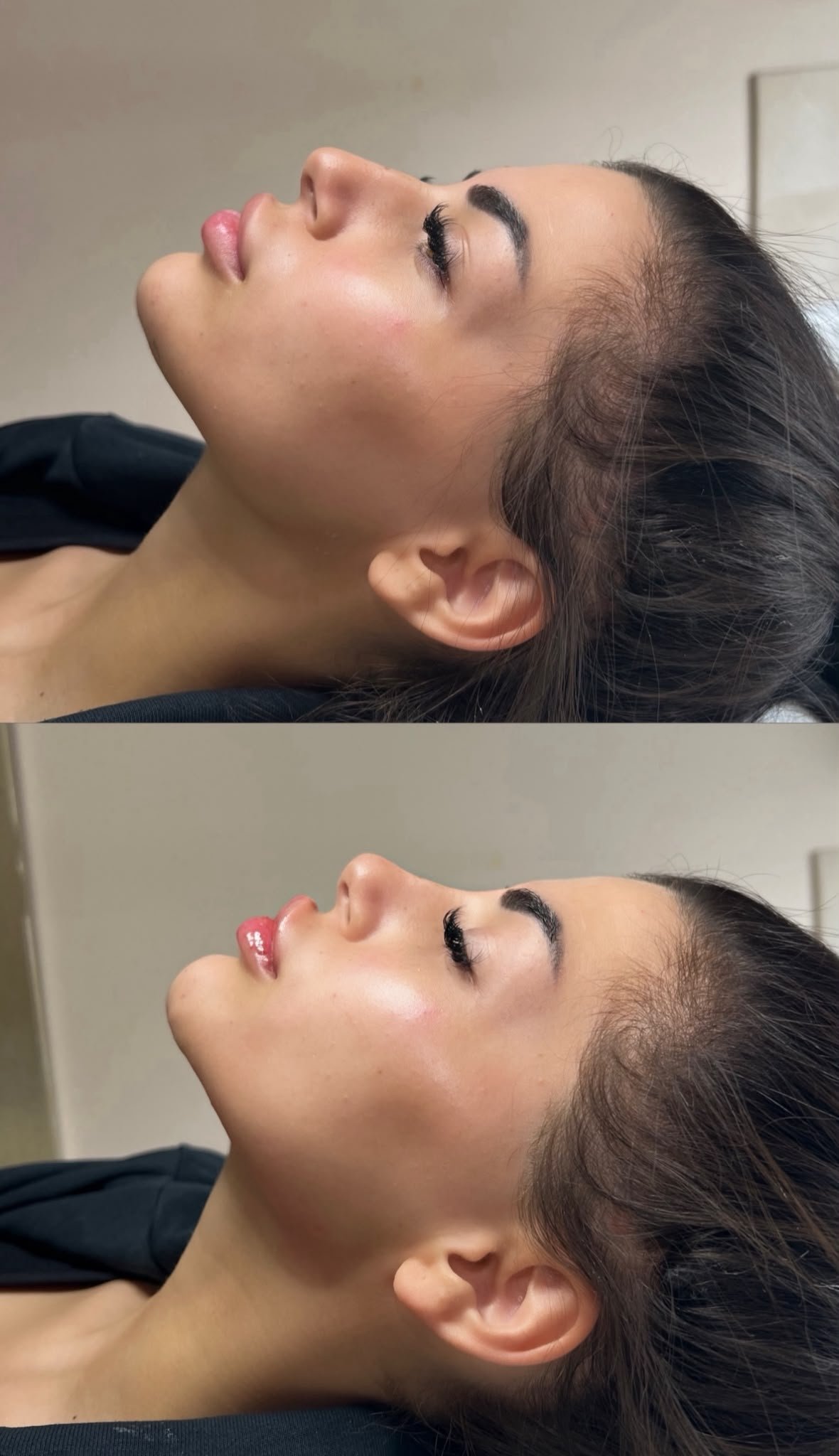 Before and after treatment result