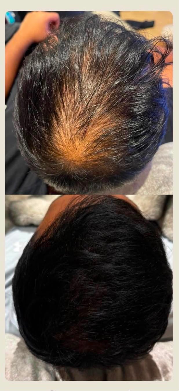 Before and after treatment result