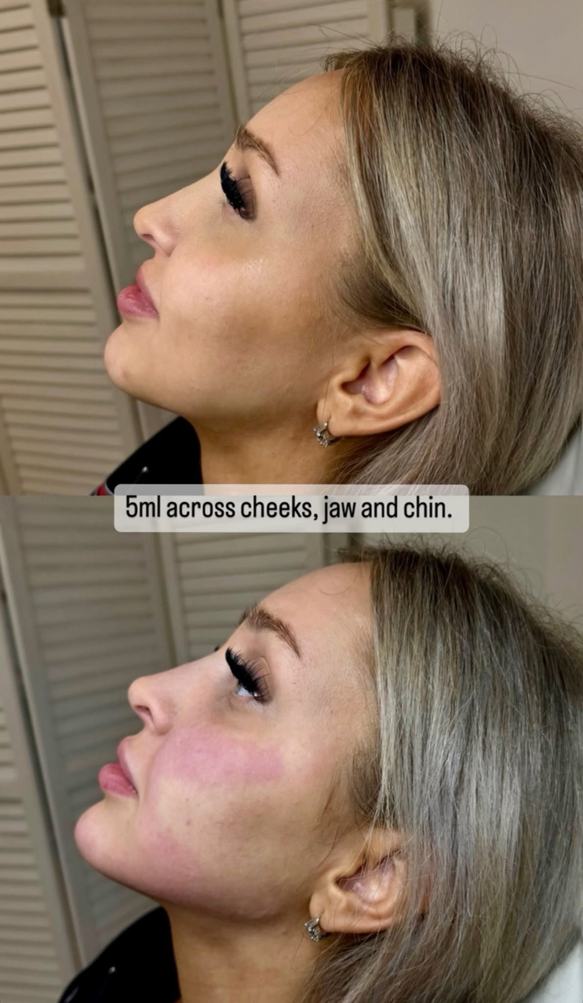 Before and after treatment result